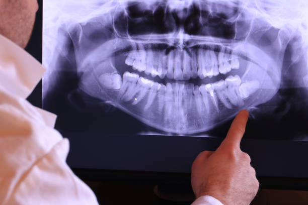 Best Broken or Chipped Tooth Repair in Waukon, IA