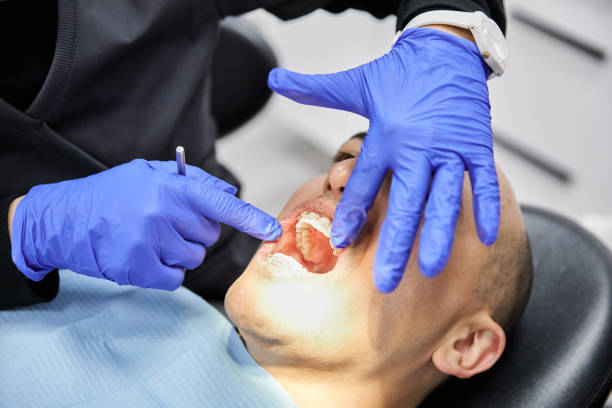 Best Knocked-Out Tooth (Avulsed Tooth) Treatment in Waukon, IA